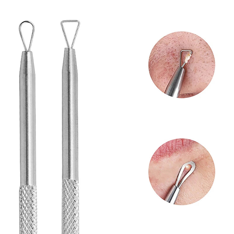 Dual Heads Acne  Blackhead Remover Needle