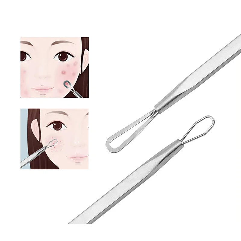 Dual Heads Acne  Blackhead Remover Needle